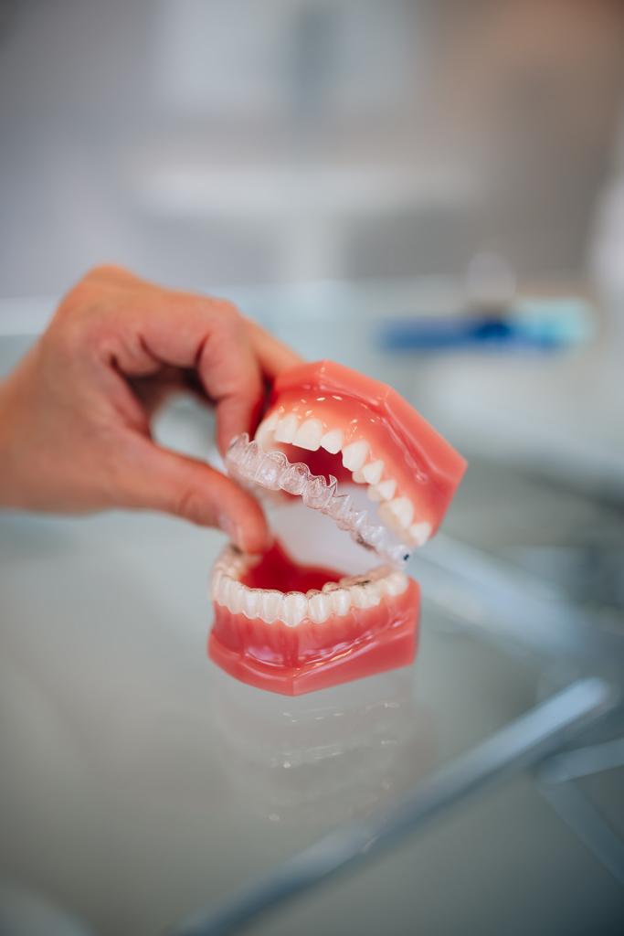 invisalign-image